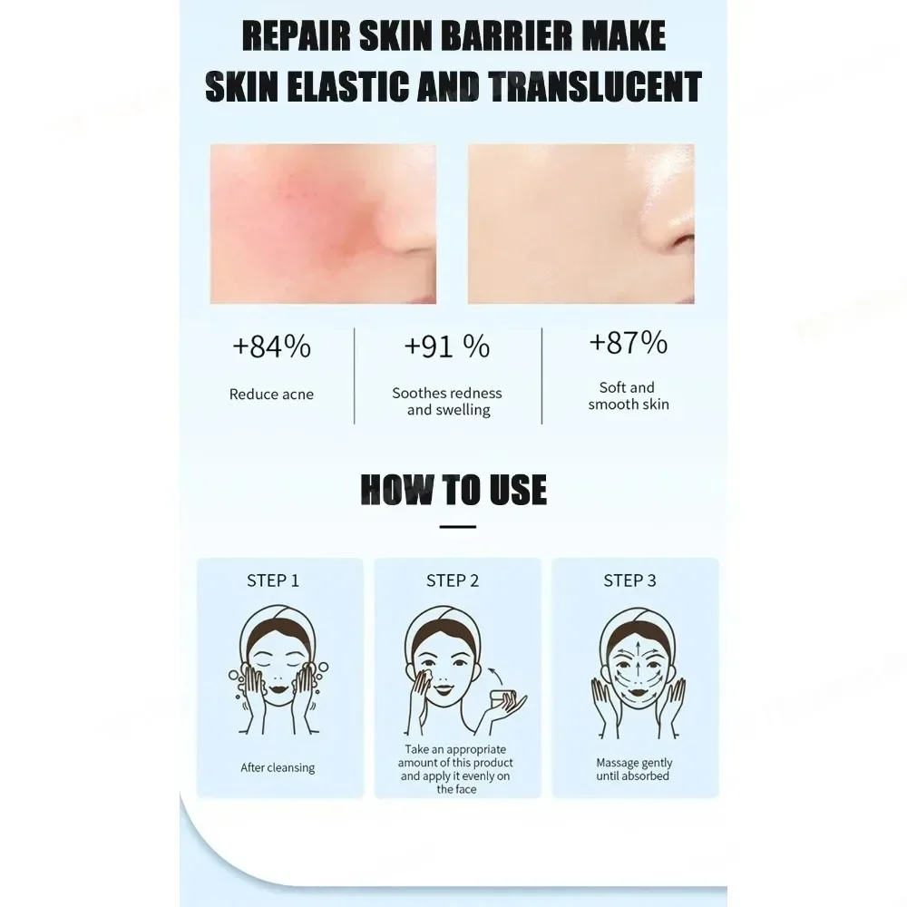 Face Serum Fruit Acid Acne Treatment Oil Control Remove Blackheads Shrink Pores Skin Texture Improve Care - Image 3